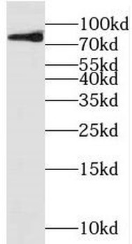 MELTF Rabbit Polyclonal Antibody