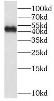 SLC49A3 Rabbit Polyclonal Antibody