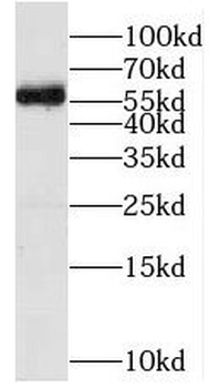 MFSD8 Rabbit Polyclonal Antibody