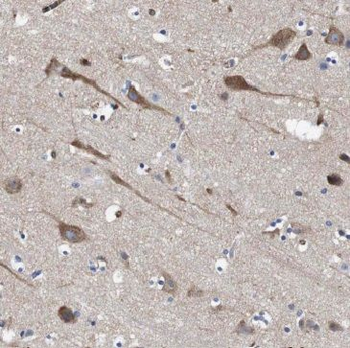 MFSD8 Rabbit Polyclonal Antibody