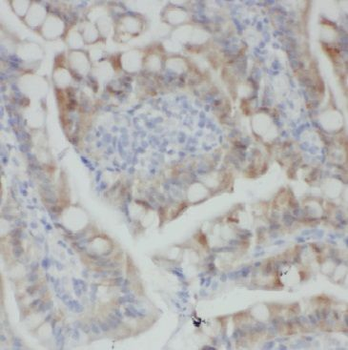 MGAT4A Rabbit Polyclonal Antibody