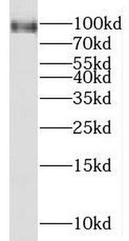 MGAT5B Rabbit Polyclonal Antibody