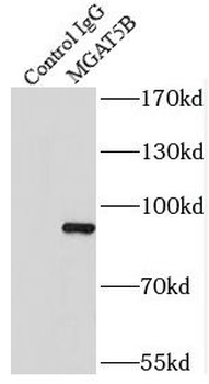 MGAT5B Rabbit Polyclonal Antibody