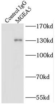 OGA Rabbit Polyclonal Antibody