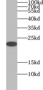 MGMT Antibody