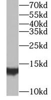 MGP Rabbit Polyclonal Antibody
