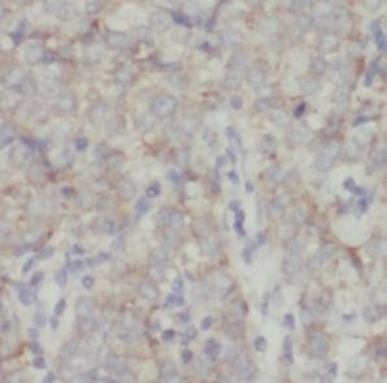 MGP Rabbit Polyclonal Antibody