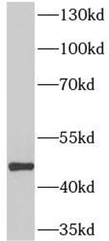 MICB Rabbit Polyclonal Antibody