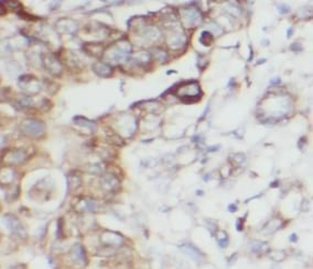 MICB Rabbit Polyclonal Antibody