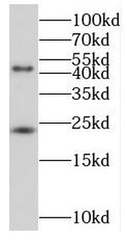 MID1IP1 Rabbit Polyclonal Antibody
