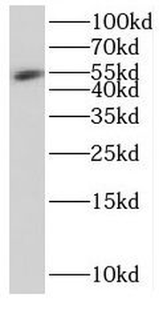 MIER3 Rabbit Polyclonal Antibody