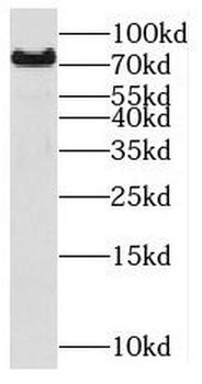 MIPEP Rabbit Polyclonal Antibody
