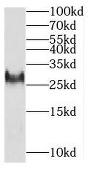 MITD1 Rabbit Polyclonal Antibody