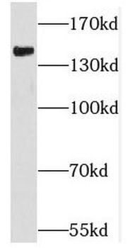 MRTFA Rabbit Polyclonal Antibody