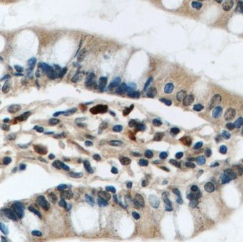 MRTFA Rabbit Polyclonal Antibody