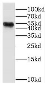 DUSP4 Rabbit Polyclonal Antibody