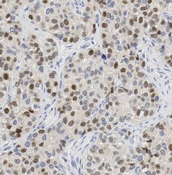 DUSP4 Rabbit Polyclonal Antibody