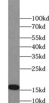 MLANA Rabbit Polyclonal Antibody