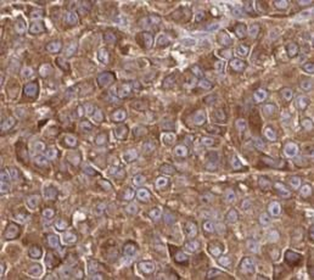 MLANA Rabbit Polyclonal Antibody