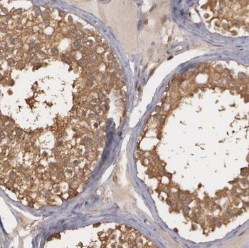 CENPU Rabbit Polyclonal Antibody