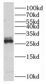 MLF2 Rabbit Polyclonal Antibody