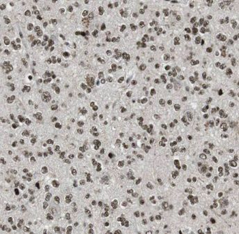 MLF2 Rabbit Polyclonal Antibody