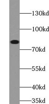 MLH1 Rabbit Polyclonal Antibody