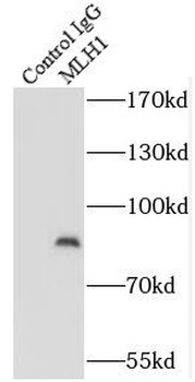MLH1 Rabbit Polyclonal Antibody