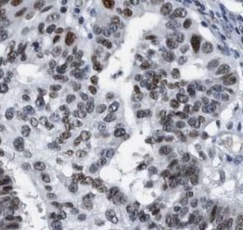 MLH1 Rabbit Polyclonal Antibody