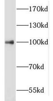 KMT2E Antibody