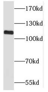 CASC3 Rabbit Polyclonal Antibody