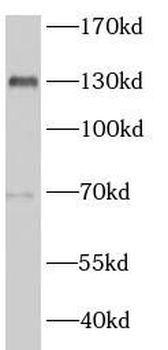 MLXIP Antibody