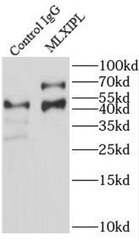 MLXIPL Antibody