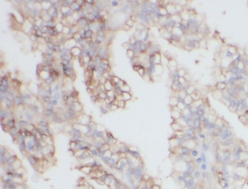 MME Mouse Monoclonal Antibody