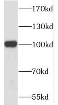 MMS19 Rabbit Polyclonal Antibody