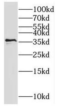 MNAT1 Rabbit Polyclonal Antibody
