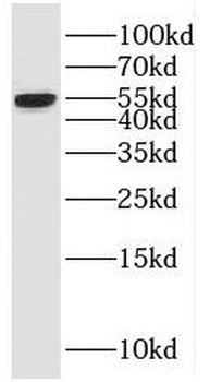 MNDA Rabbit Polyclonal Antibody