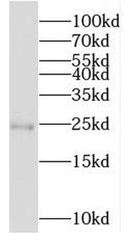 MOB4 Rabbit Polyclonal Antibody