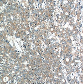 MOB4 Rabbit Polyclonal Antibody