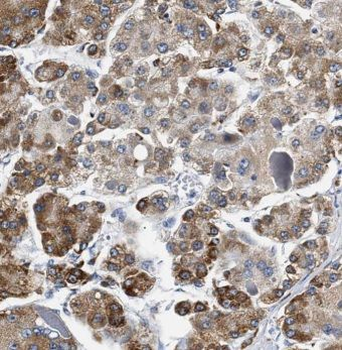 MOGAT1 Rabbit Polyclonal Antibody