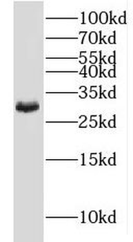 MOGAT2 Antibody