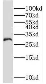 MOGAT2 Antibody