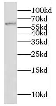 MOXD1 Rabbit Polyclonal Antibody