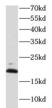 MPC2 Rabbit Polyclonal Antibody