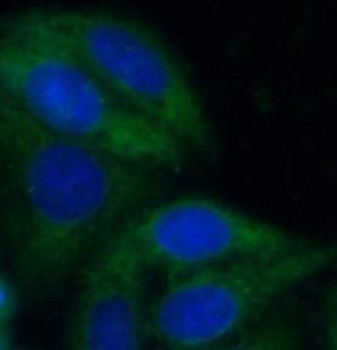 MPC2 Rabbit Polyclonal Antibody