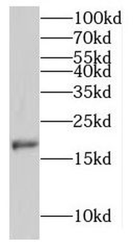 MPHOSPH6 Rabbit Polyclonal Antibody