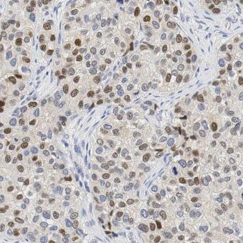 MPHOSPH6 Rabbit Polyclonal Antibody