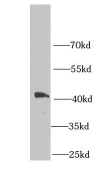 MPI Rabbit Polyclonal Antibody