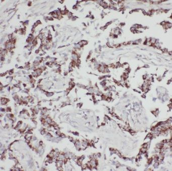 MPP3 Rabbit Polyclonal Antibody