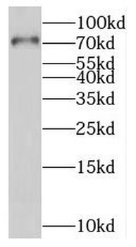 PALS1 Rabbit Polyclonal Antibody